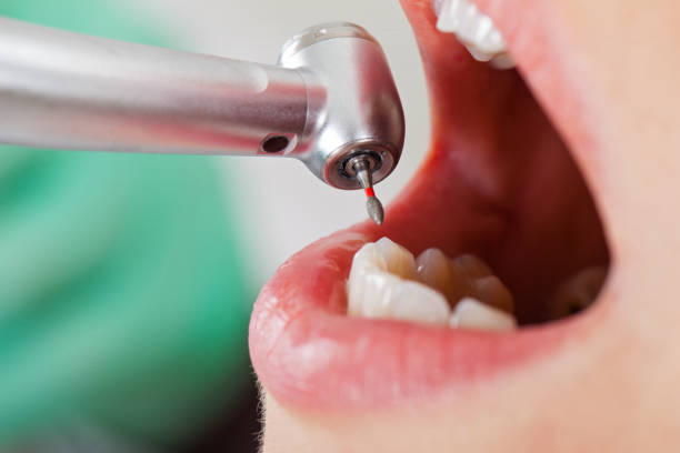 Best Emergency Denture Repair in Johnsburg, IL